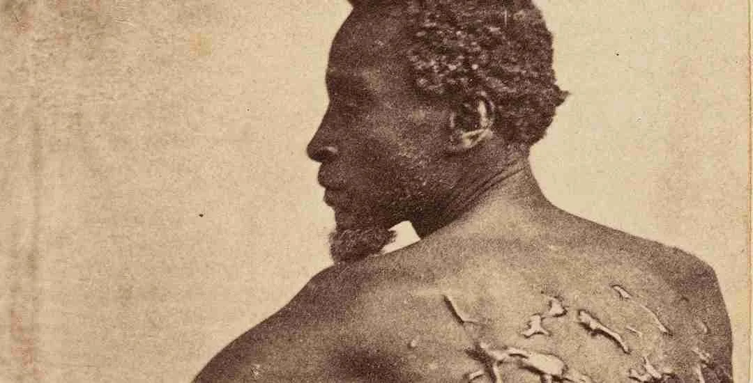The Story Behind "The Scourged Back" Photograph: Whipped Peter, Gordon, and an Image That Exposed Slavery